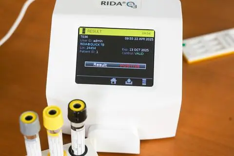 Der "Rida Quick TB"-Test kann Tuberkulose schon nach 15 Minuten erkennen.