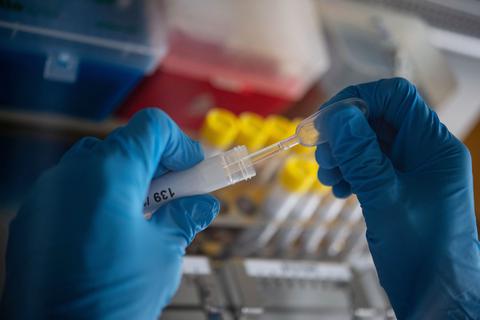 Eine Mitarbeiterin pipettiert in einem Labor Proben mit Verdacht auf Viren.  Symbolfoto: dpa