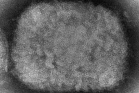 Diese elektronenmikroskopische Aufnahme aus dem Jahr 2003, die von den Centers for Disease Control and Prevention zur Verfügung gestellt wurde, zeigt ein Affenpockenvirus, das aus einer Probe im Zusammenhang mit dem Präriehundeausbruch von 2003 stammt. Inzwischen gibt es weltweit mehrere Fälle.   Foto: Cynthia S. Goldsmith/CDC via AP/dpa