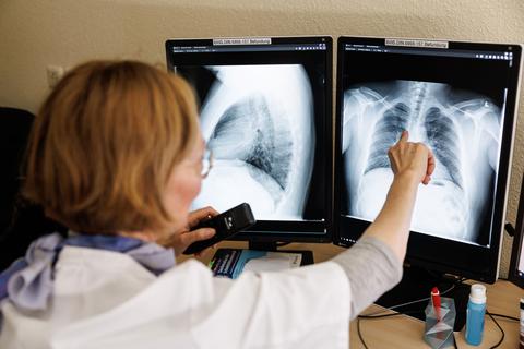 Eine Radiologin analysiert in ihrem Büro Röntgenbilder einer Lunge.